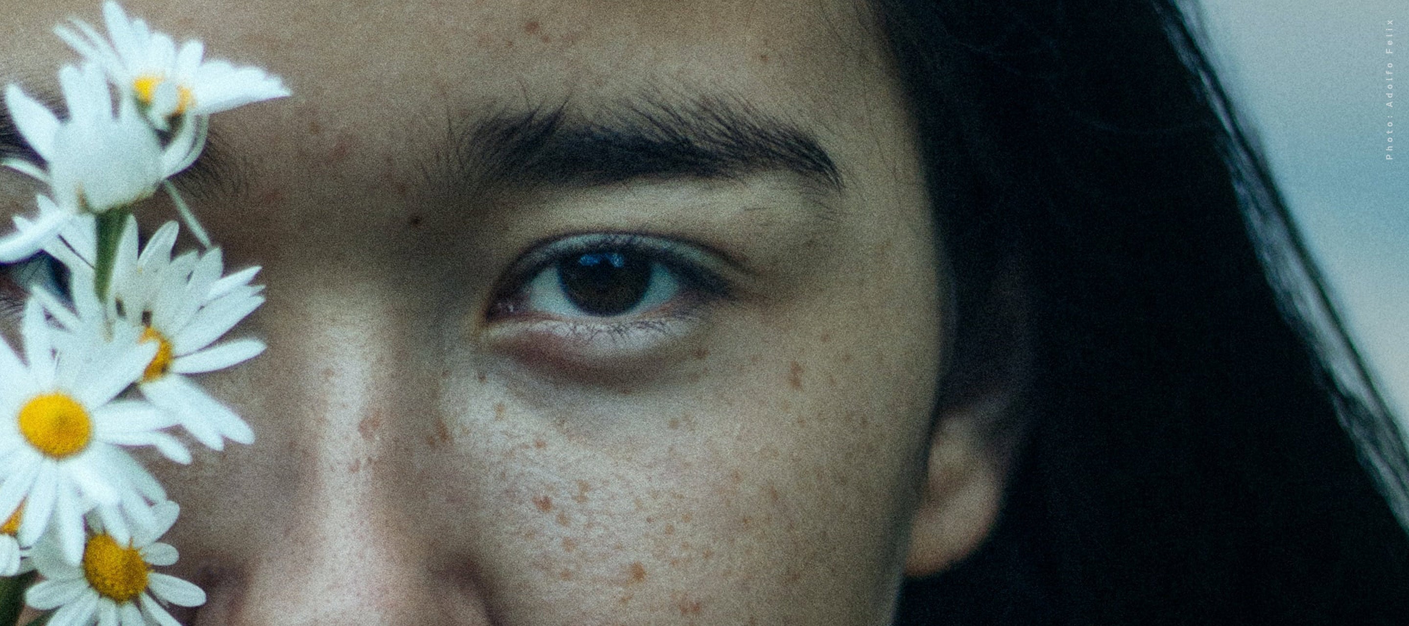 Close-up of a person's face with freckles, partially obscured by white daisy flowers.