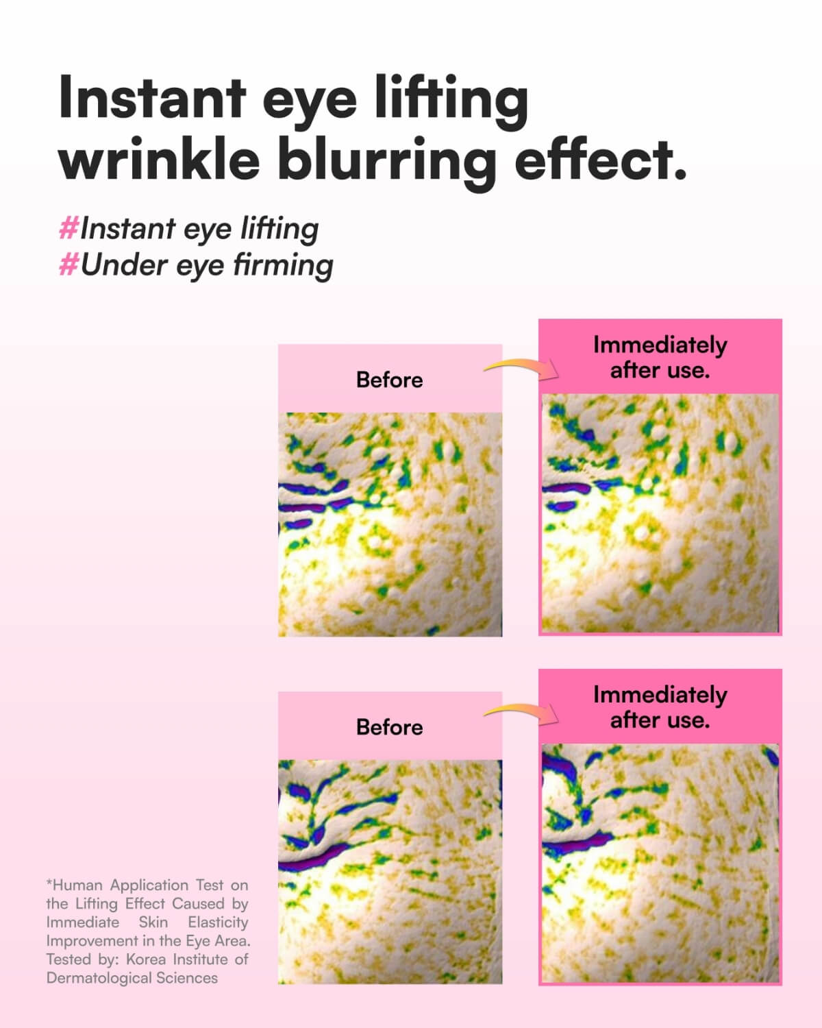 Before and after clinical test results of Face Republic Blooming Collagen Eye Booster for wrinkle blurring.