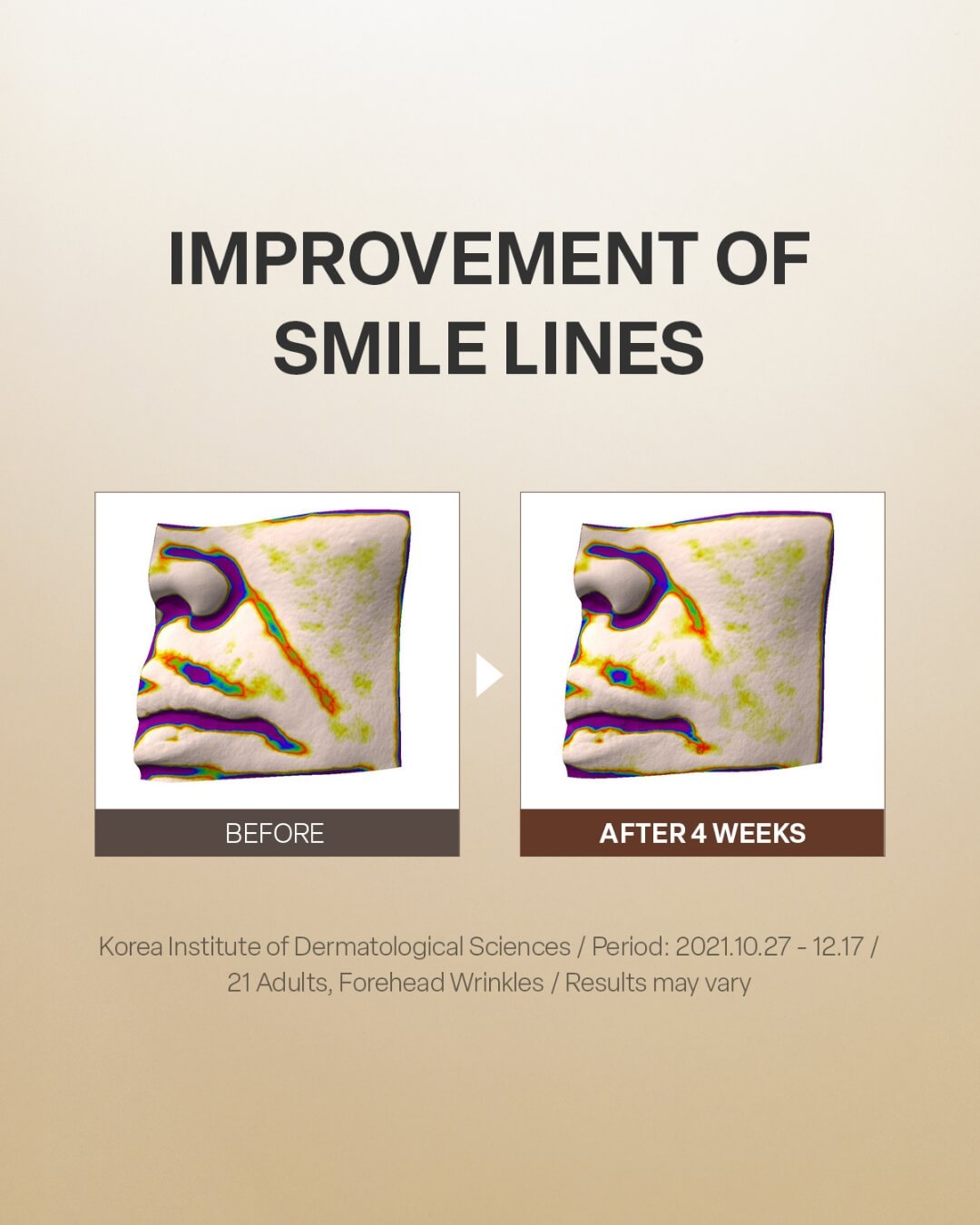 Before and after clinical test results diagram demonstrating improvement of facial smile lines over four weeks.