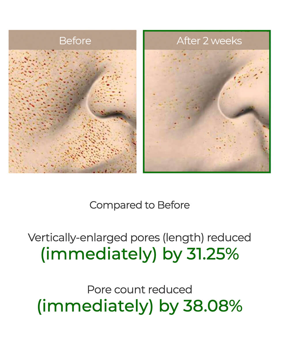 Ohlolly K-Beauty Skincare VT Cosmetics Reedle Shot 100. Clinically tested results. Skin texture improvement. View A.