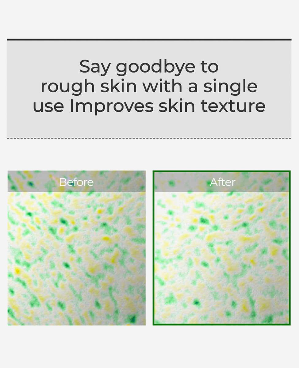 Ohlolly K-Beauty Skincare VT Cosmetics Reedle Shot 100. Clinically tested results. Skin texture improvement. View B