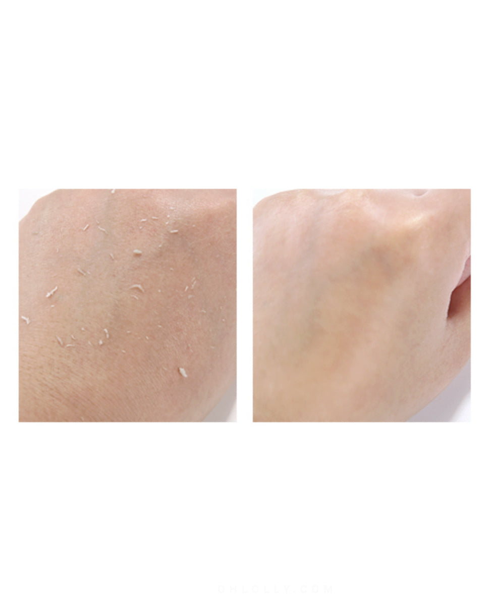 Side-by-side comparison of skin before and after using the Pyunkang Yul Peeling Gel. The left image shows rough, flaky skin with clumps of exfoliated product, and the right image shows skin that is visibly smoother and softer.