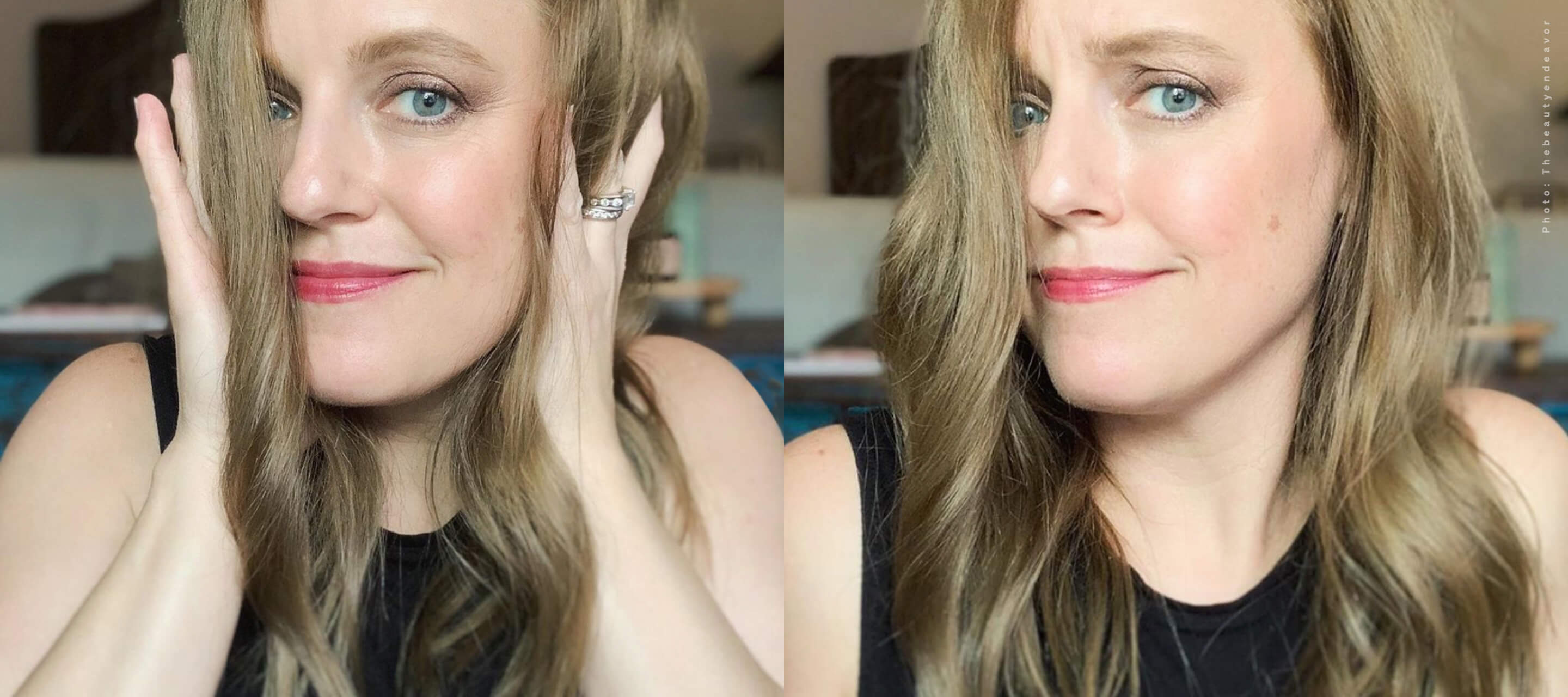 Side-by-side comparison photos of a woman with blonde hair, one showing her touching her face and the other a natural smiling portrait.