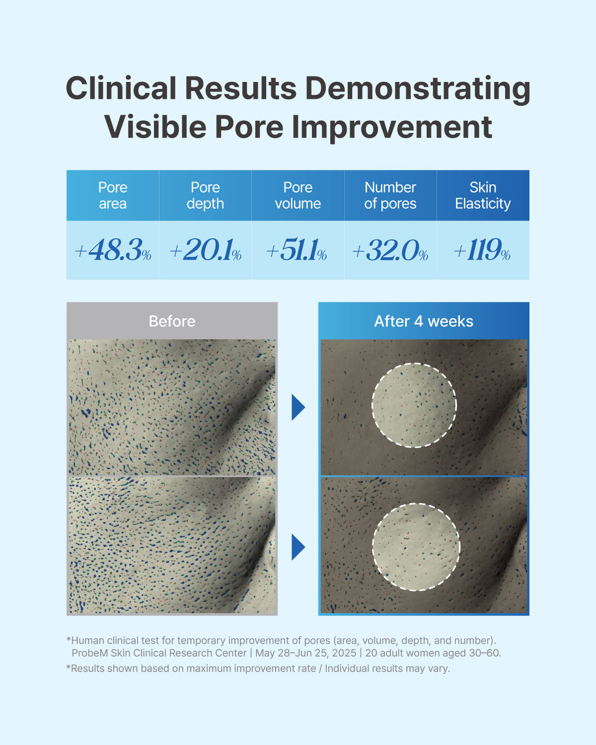 Clinical results chart showing visible pore improvement, area reduction, and skin elasticity increase after 4 weeks.