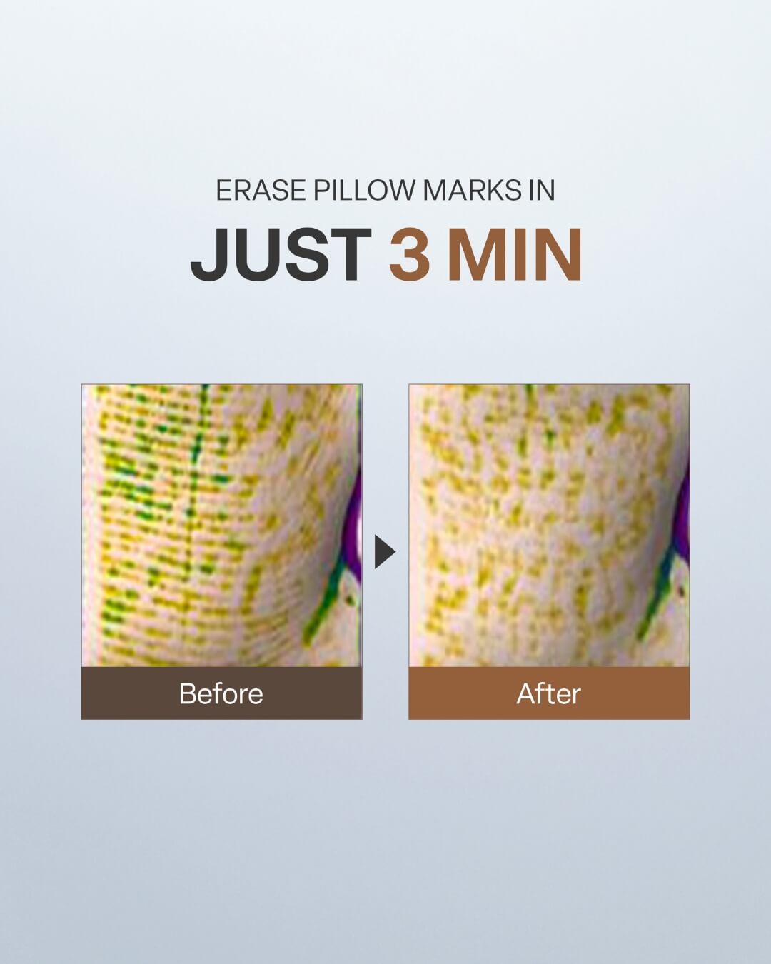 Before and after skin comparison showing pillow marks erased in 3 minutes using Koy Flow Lifting Wrapping Cream.