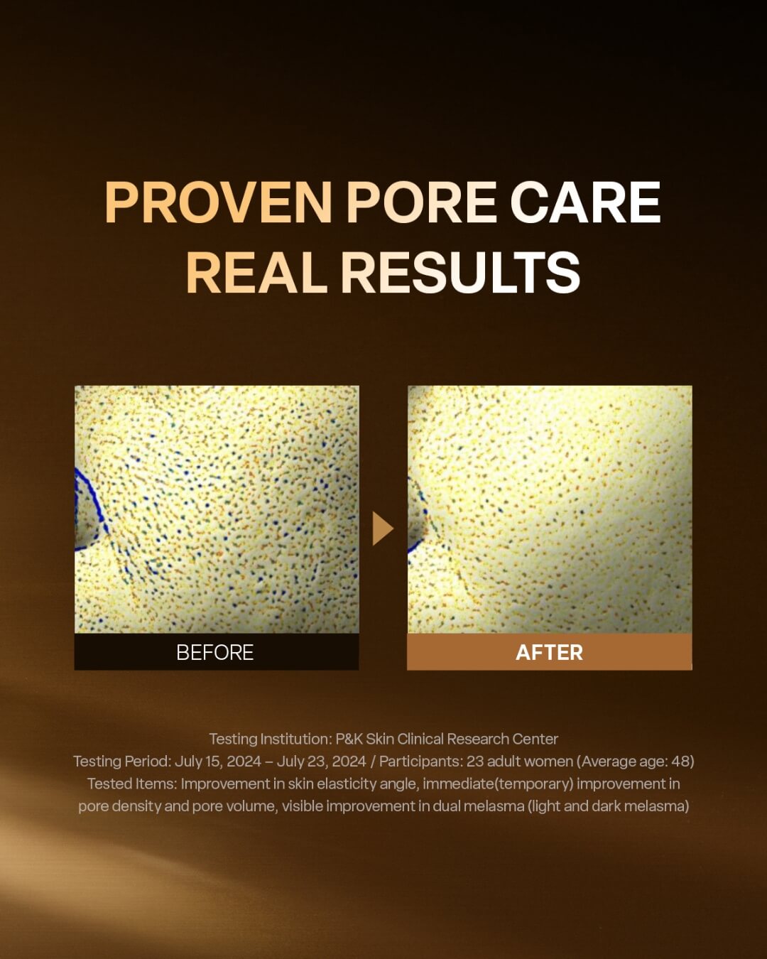 Before and after close-up skin texture comparison showing proven pore care and elasticity results.