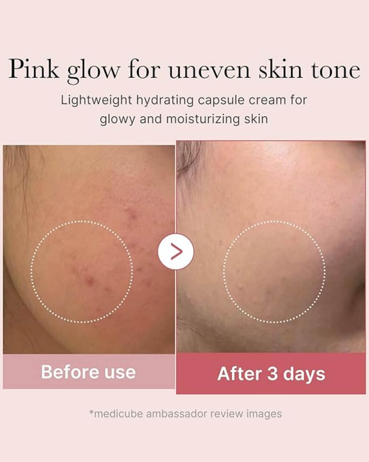 Medicube PDRN Pink Collagen Capsule Cream, infographic - lightweight hydrating capsule cream for glowy and moisturizing skin, model showing before and after 3 days use